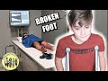 KID BREAKS his ANKLE playing SOCCER | A DOCTOR says his FOOT is BROKEN | KIDS FIRST BROKEN BONE