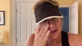 TMI GRAPHIC - INVERTED PAPILLOMA | SURGERY RECOVERY