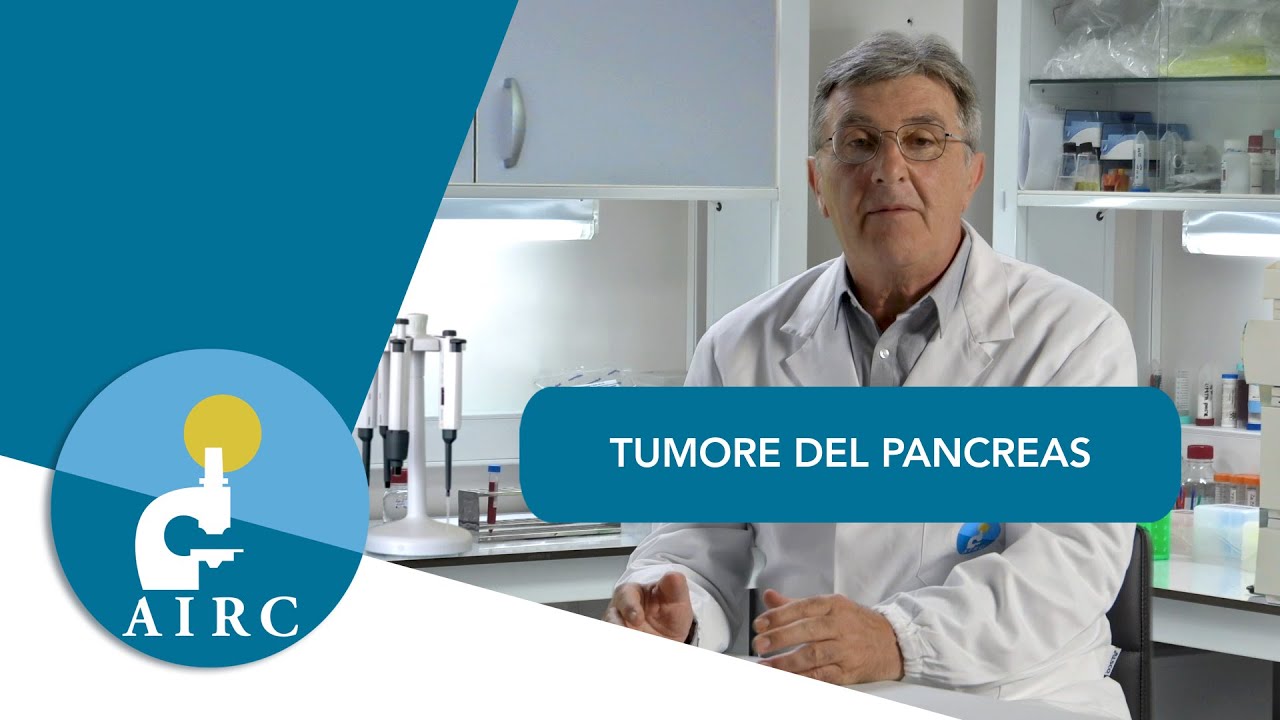 Come prevenire il tumore del pancreas