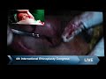 Jaipurdoorbeen hospital live stream