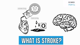What is Stroke or CVA