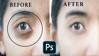 How to Remove Eye Dark Circal & photo Retouching  In M M photoshop tutorials...