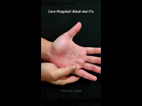 Cara Mengobati Batuk dan Flu