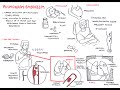 Pulmonary embolism  overview