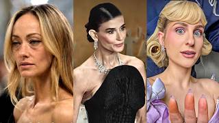 Celebrities SWEAR They’re Not Using Ozempic… But Then Got CAUGHT Lying
