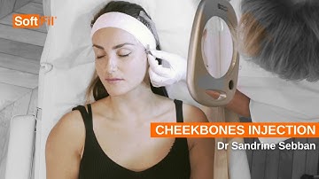 SoftFil® Medical | Cheekbones Injection | EasyGuide 22G50mm
