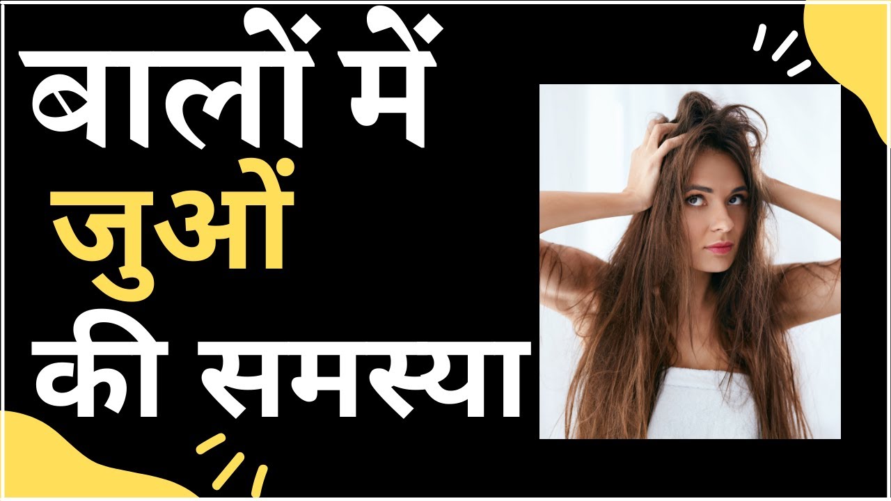 Hair Lice Treatment How to Get Rid of Lice Head Lice Pediculosis Dr. Mukesh Aggarwal