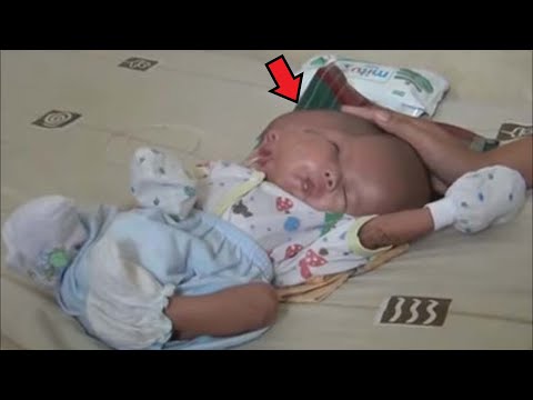 Video: Kas sisekontroll toob kaasa sünnituse?