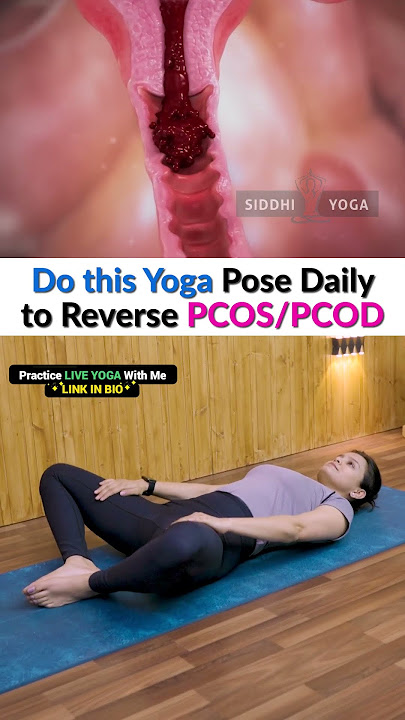 Manage PCOD & PCOS with These Yoga Poses | Siddhi Yoga