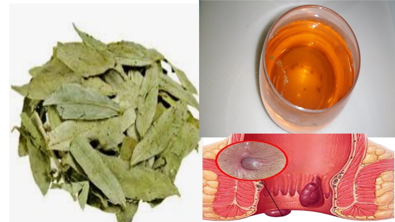 HOJAS DE SEN PARA PERDER PESO, LIMPIAR EL COLÓN, ELIMINA LA RETENCIÓN