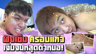 ครอบแก้ว ฝังเข็ม ใครบอกชิว? | คนพันธุ์เสือ EP.77 | SHOCKER BOYS