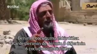 Bir Derdin Mi Var ? İzle