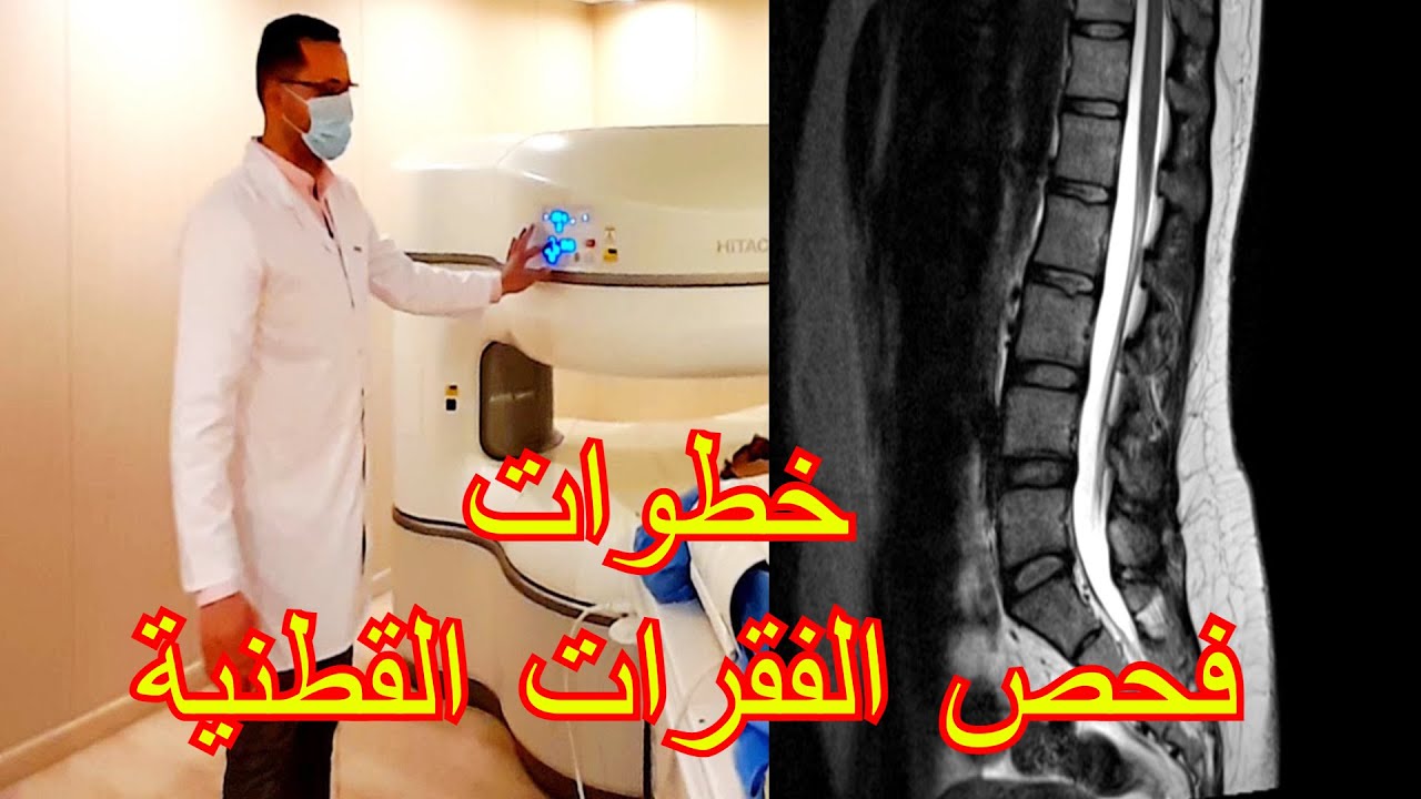 MRI L S S TECHNIQUE  الرنين المغناطيسي علي الفقرات القطنية