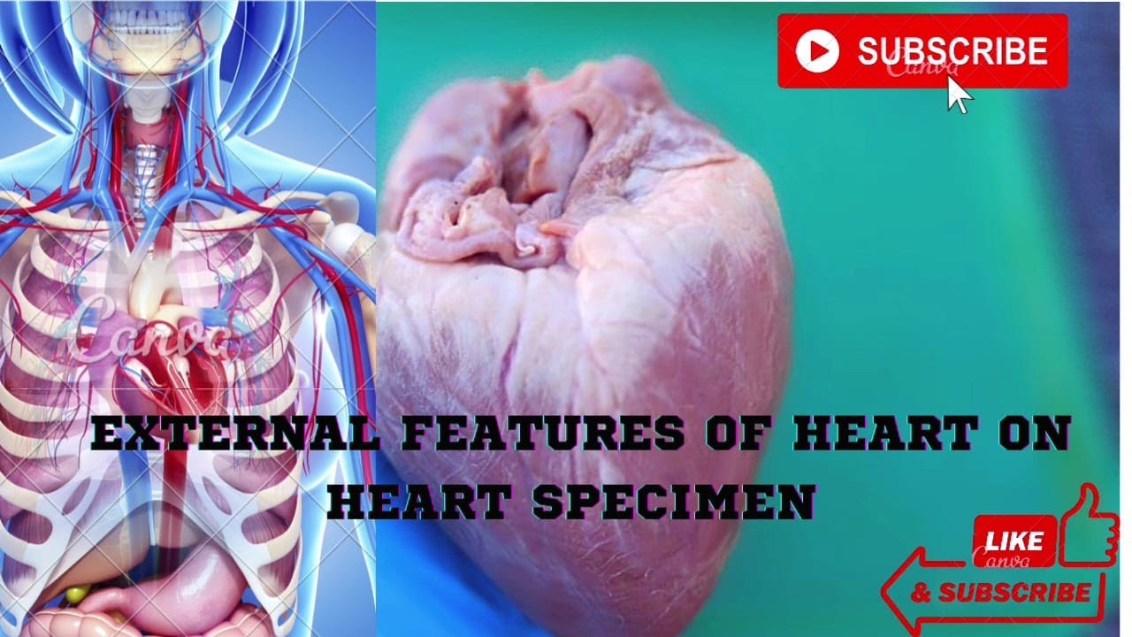HEART ANATOMY DEMONSTRATIONOF EXTERNAL FEATURES OF HEART ON HEART