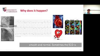 BHF Live & Ticking February 2021 – Takotsubo Cardiomyopathy
