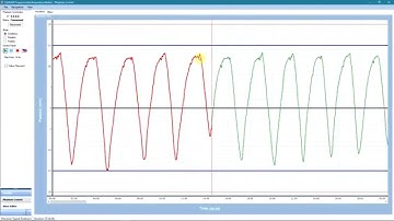Test Patient-Specific Waveforms on Radiotherapy Systems using Motion QA Software from ModusQA.com