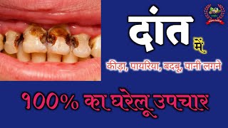 दांत और मुंह के सभी समस्याओं का घरेलू उपचार-डॉ. देवेन्द्र कुमार/प्राकृतिक चिकित्सा