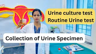 Urine Test / Mid Stream Specimen/ Collection of specimen / Urine culture test/ Routine urine test
