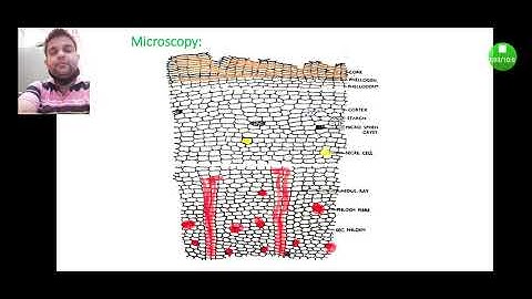 Result of morphology and microscopy of Cinchona bark