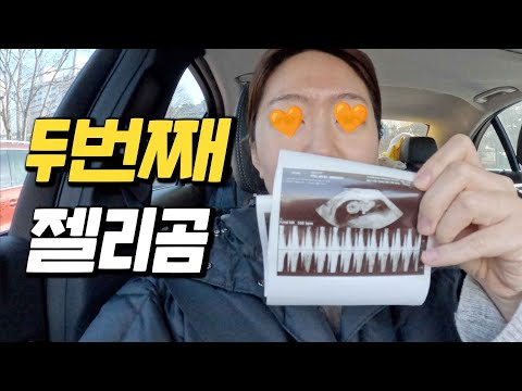 두번째 젤리곰, 그리고 쉬어 가는 시간이었던.