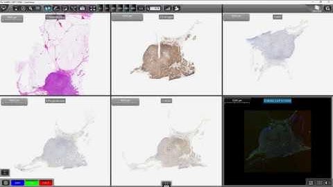 3DHISTECH - Automatic Slide Alignment in CaseViewer
