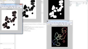 Segmentation of Overlapping Elliptical Objects in Silhouette Images|IEEE 2016 Matlab Projects