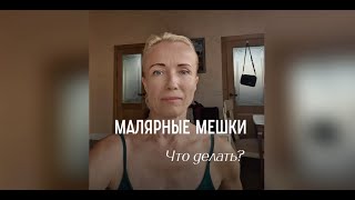 ❤️🔥Почему мешки под глазами не уходят даже после сна? #мешкиподглазами