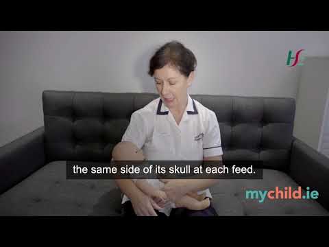 Video: Bebeluș Cu Cap Plat (Plagiocefalia): Simptome, Cauze, Tratament