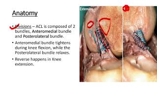 Anterior cruciate ligament injuries (ACL) -Anatomy, Functions, Tear/Injury, Diagnosis and Treatment