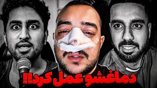جزئیات دعوای سام صابری و عمل دماغ‼️شایعه عجیب راجب مرگ رسول دیواکس ❌آیا لایو فلیم حسین ویو فیک داشت؟