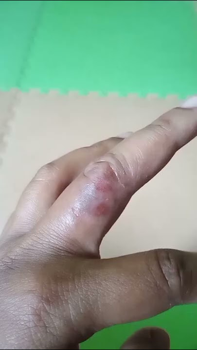 EKSIM...garuk sana garuk sini akhirnya ketemu VASELINE || 🥰👍 #shorts