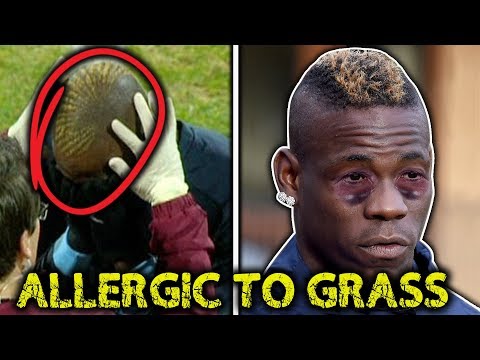 10-most-ridiculous-football-injuries!