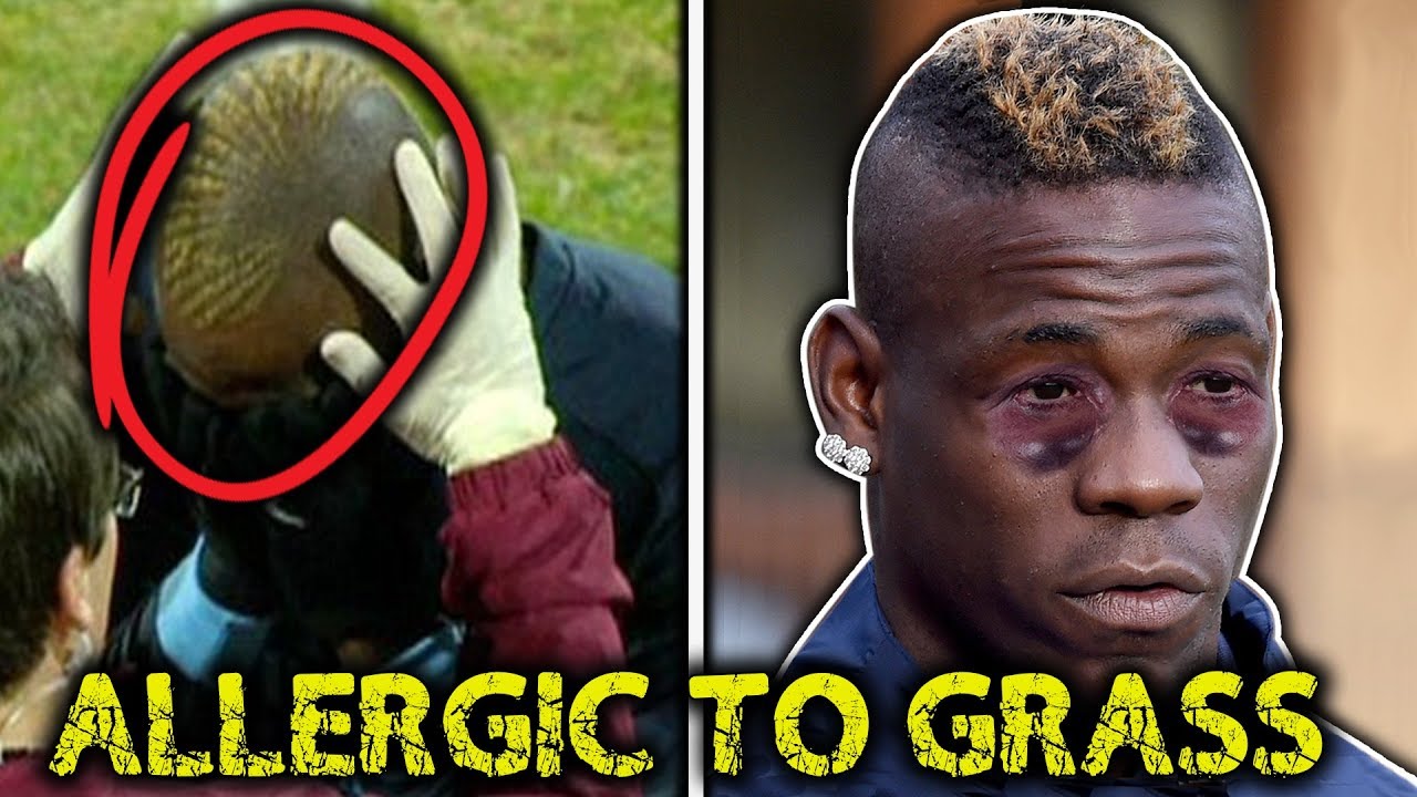 10 Most RIDICULOUS Football Injuries!