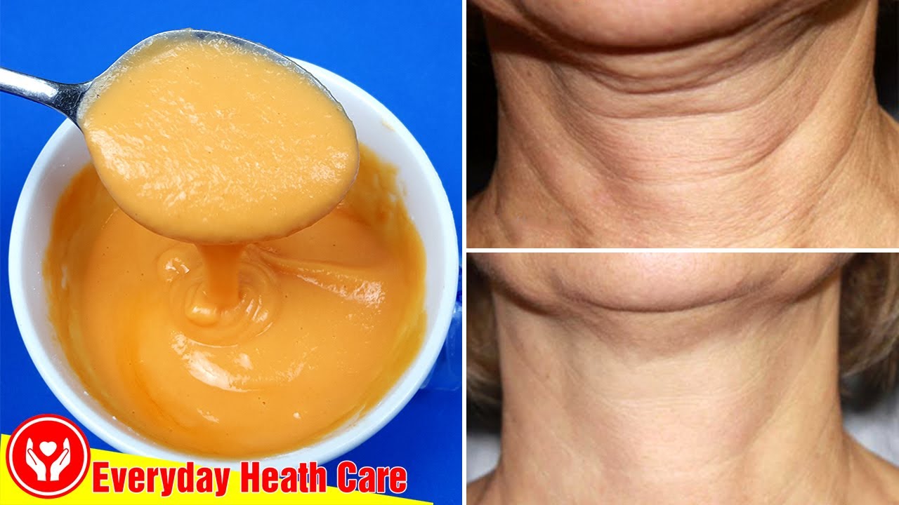 Apply This 2 Times A Week, REMOVE DEEP WRINKLES On NECK And CHEST