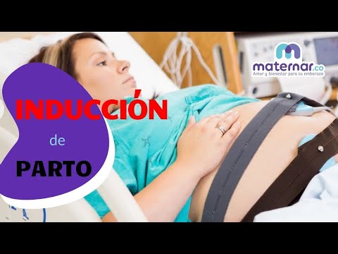 Video: ¿Por qué la inducción del parto?