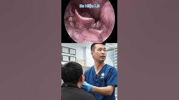 Hóc xương.cá qua 1 đêm cảm giác thật tệ ạ. #Bacsihieulongbien #bacsihieutaimuihong