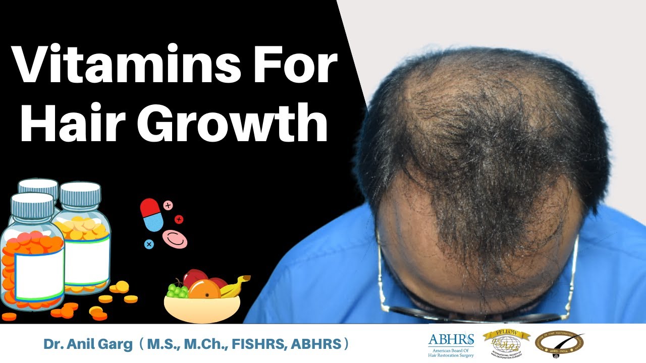 Vitamins For Hair Growth | BIOTIN & Hair Growth Supplements | किस