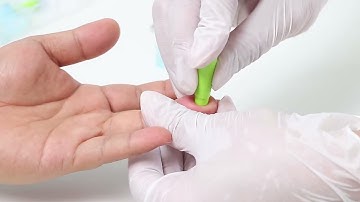 微流控白细胞分析仪操作视频  Operation Video of Microfluidic WBC Analyzer