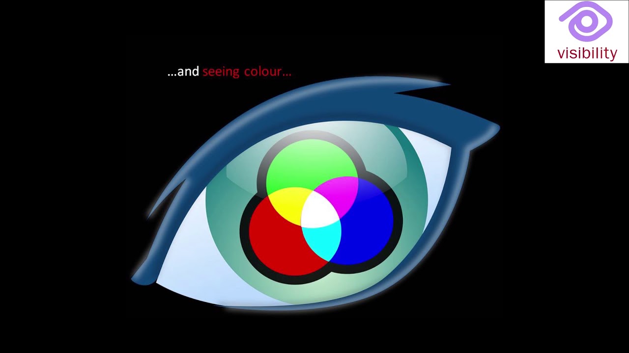 Gordon Dutton talks about CVI