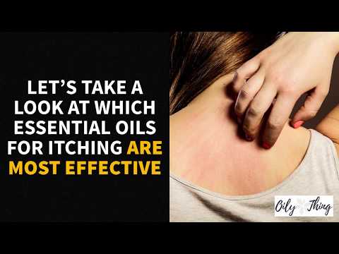 5 Best Essential Oils for Itching Solutions You Can Try Today