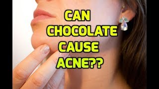 Can chocolate cause acne?