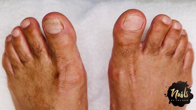 This $8 Pedicure Rasp Will Give You Disgustingly Satisfying