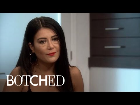 20 Doctors Have Already Turned Down Nuray's Desperate Case | Botched | E!