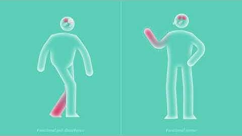 What are Functional Neurological Disorders?