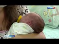 День недоношенных детей отметили в НИИ материнства и детства в Иванове