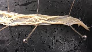 Parts of a round worm