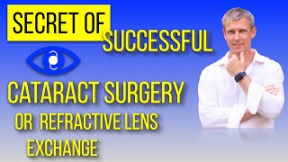 Successful cataract surgery or refractive lens exchange secret