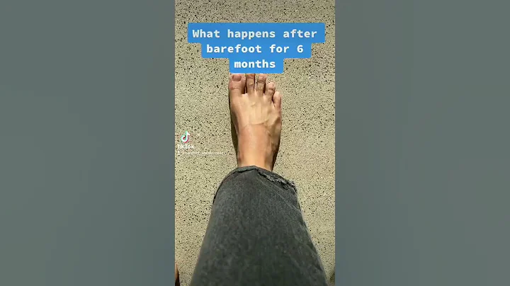 After barefoot for 6 months, my foot have changed a lot. Never go back to ‘normal’ shoe again. - DayDayNews