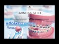 stainless-steel  !!  orthodontic wire !!   part 1, dental orthopaedic archwires,