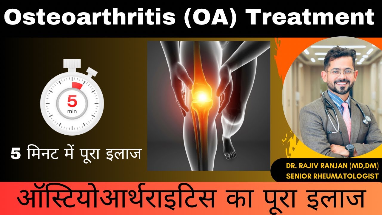 ऑस्टियोआर्थराइटिस का पूरा इलाज | Osteoarthritis Full Treatment | OA Knee Treatment